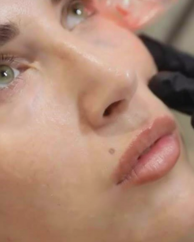 Smarter Rest After Injectables and Lasers